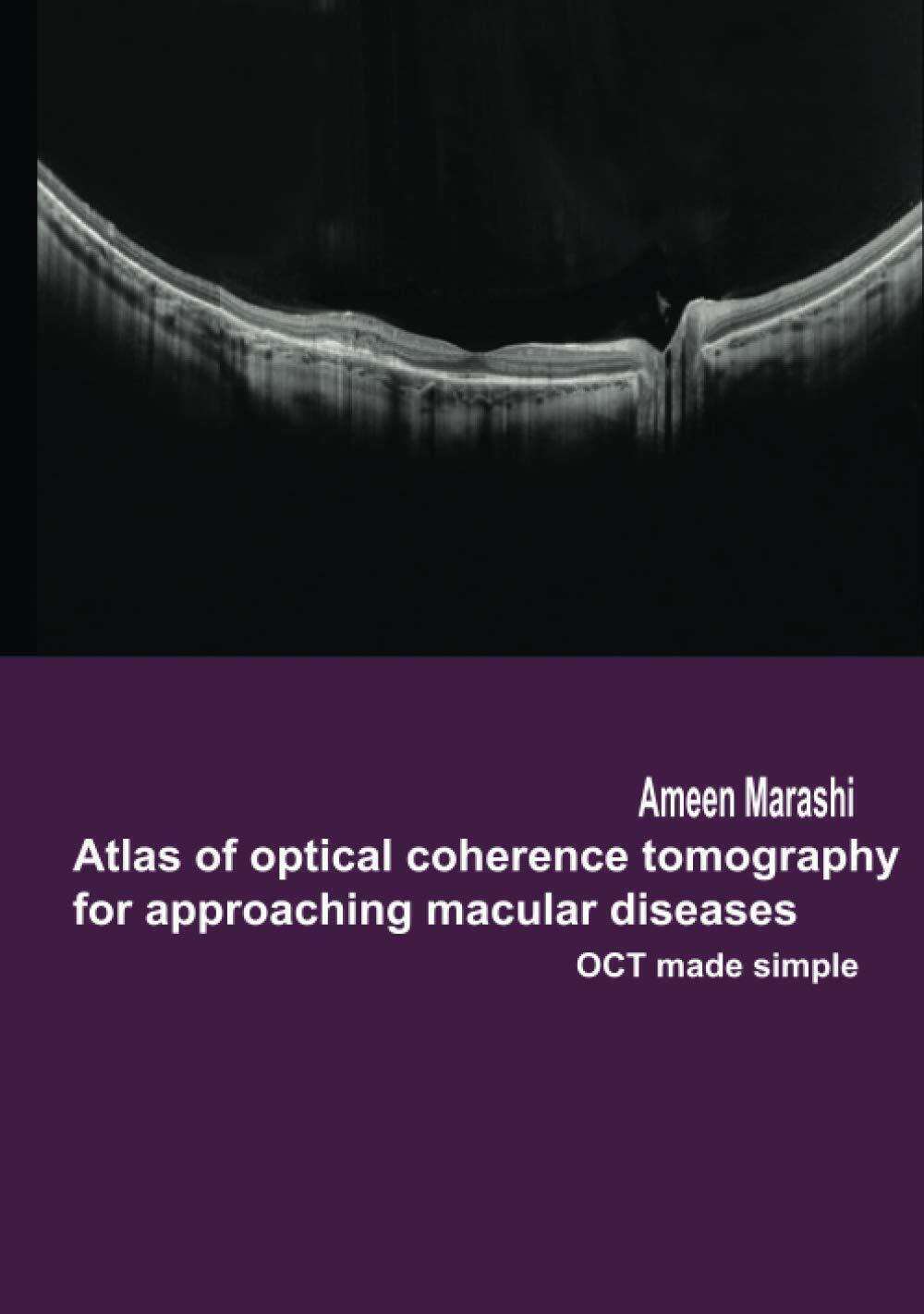 Atlas of Optical Coherence Tomography for Approaching Macular Diseases OCT Made 