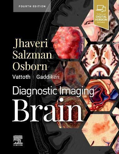Brain - Miral D. Jhaveri - Elsevier, 2020