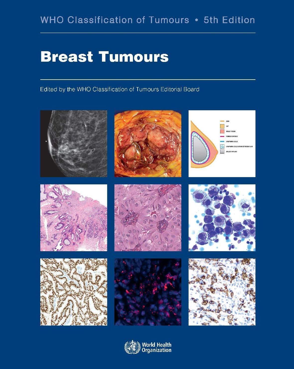 Breast Tumours - Who Classification of Tumours Editorial Board - 2019
