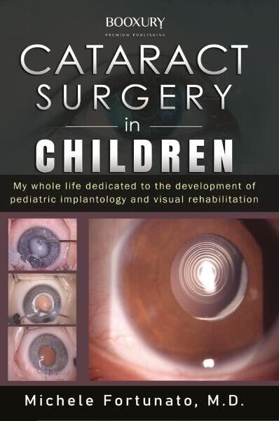 Cataract Surgery in Children di Michele Fortunato, 2022, Youcanprint