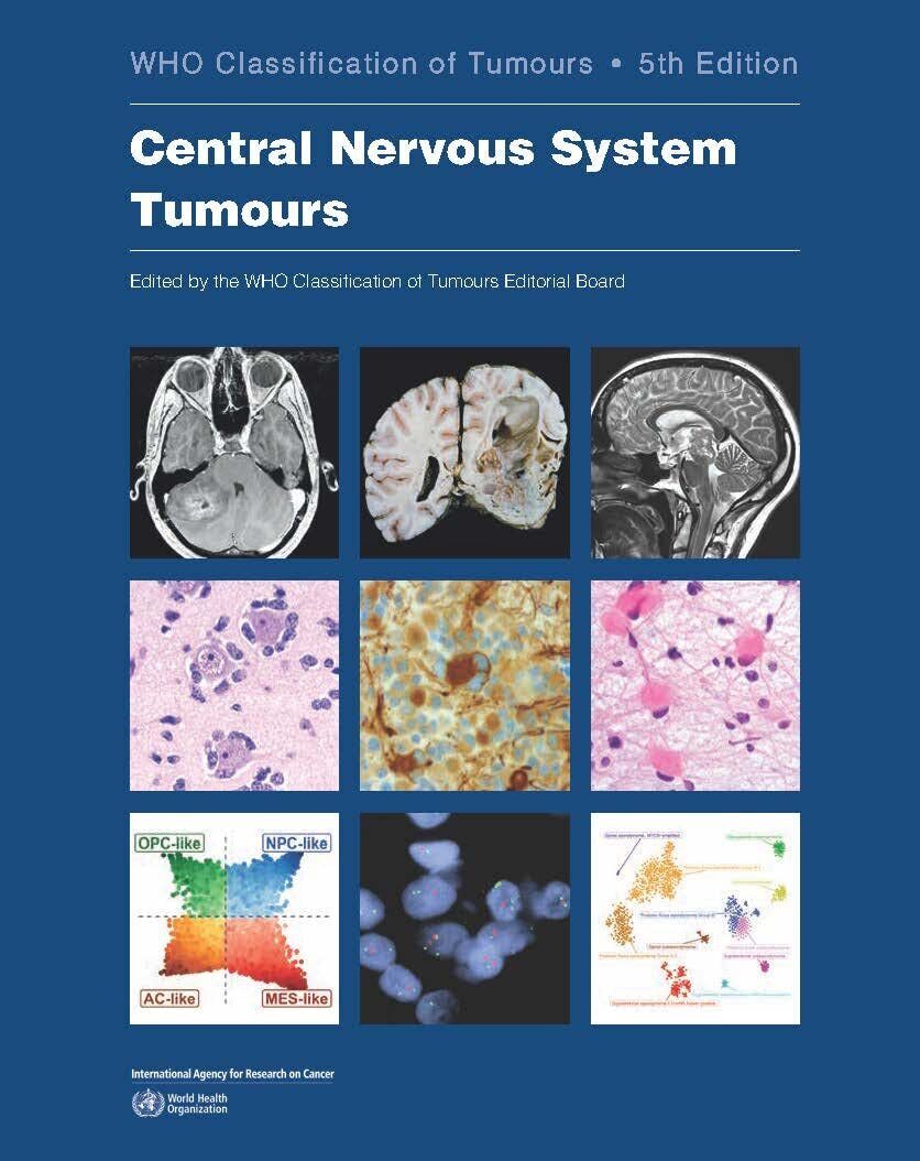 Central Nervous System Tumours - World Health Organization - 