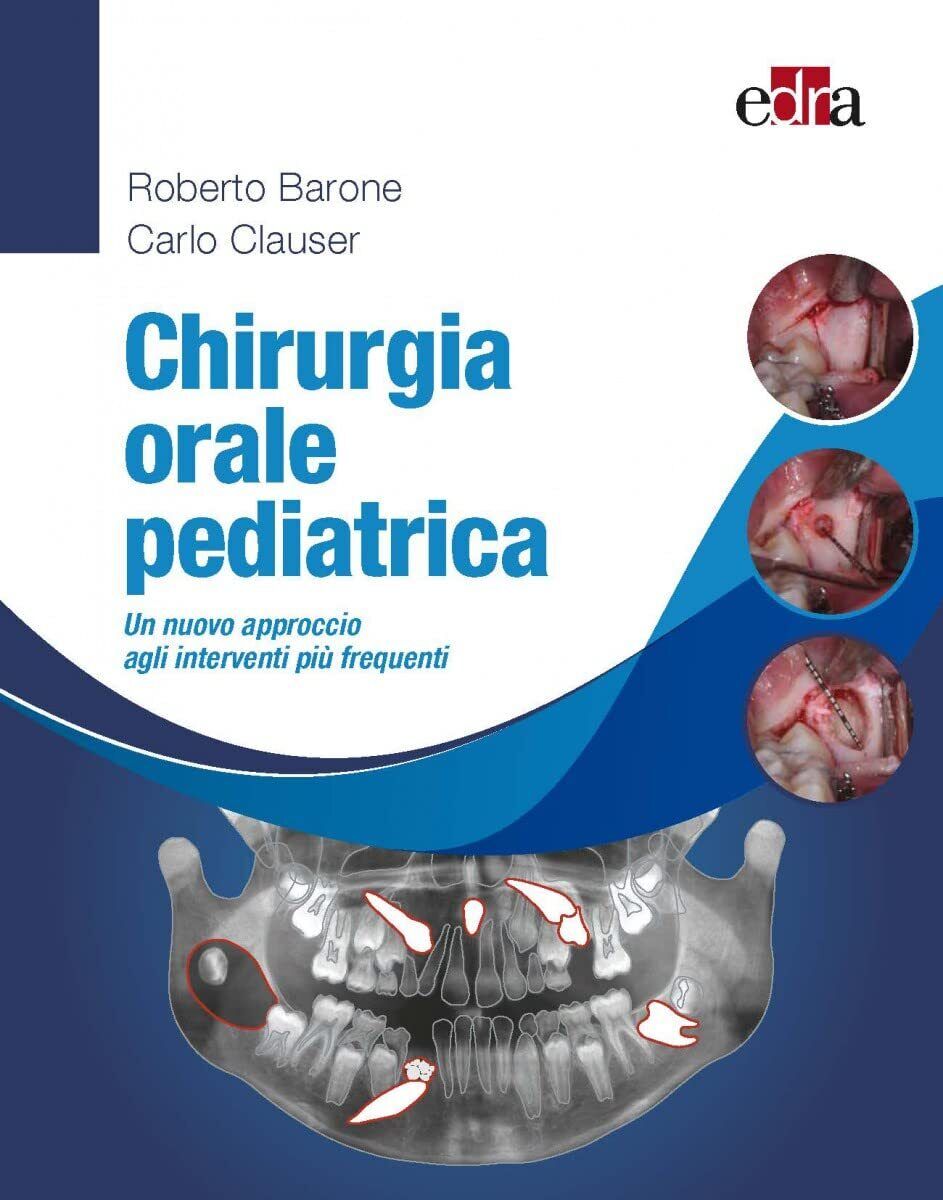 Chirurgia orale pediatrica - Roberto Barone, Carlo Clauser - Edra, 2022
