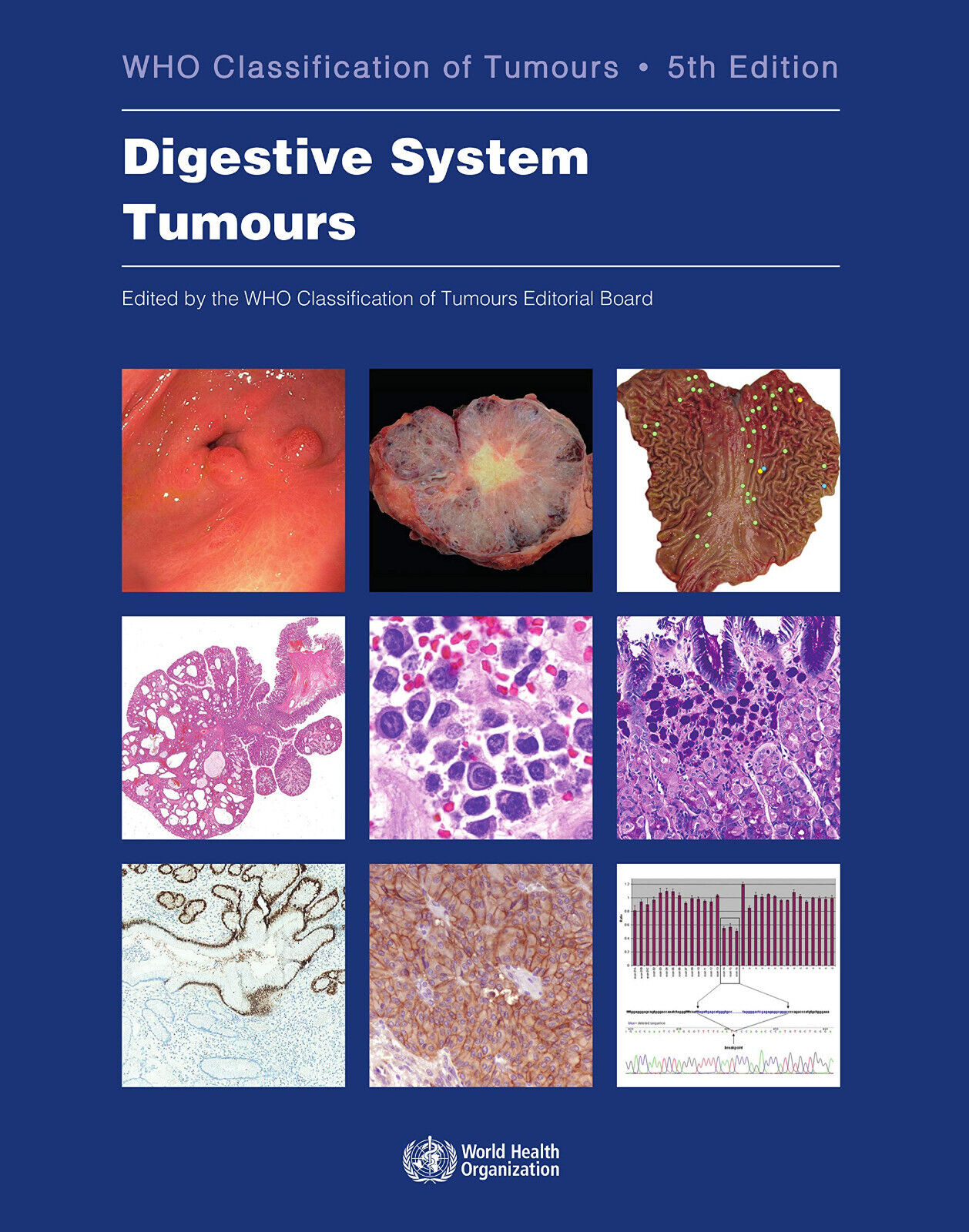 Digestive System Tumours - Who - WORLD HEALTH ORGN, 2019