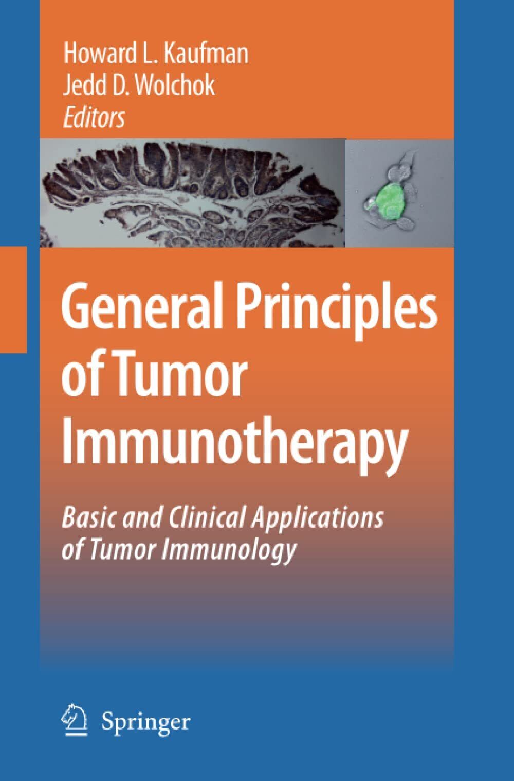 General Principles of Tumor Immunotherapy - Howard L. Kaufman - Springer, 2014