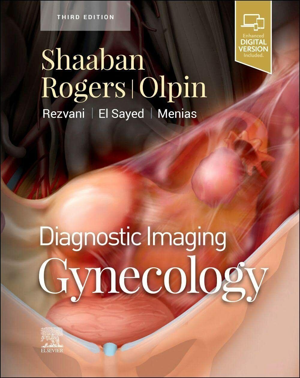 Gynecology - Akram M. Shaaban - ELSEVIER, 2021