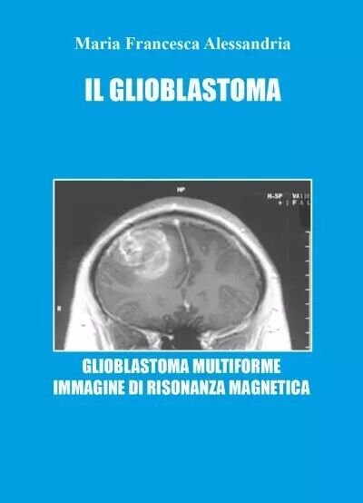 Il Glioblastoma di Maria Francesca Alessandria, 2023, Youcanprint