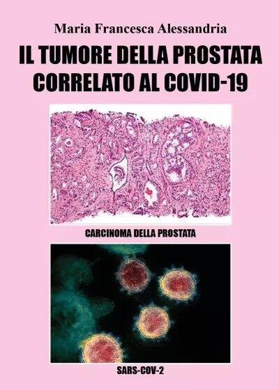 Il tumore alla prostata correlato al Covid-19 di?Maria Francesca Alessandria,??