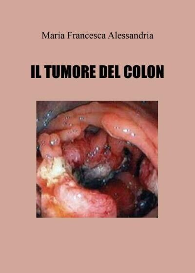 Il tumore del colon di Maria Francesca Alessandria, 2022, Youcanprint
