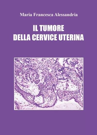 Il tumore della cervice uterina di Maria Francesca Alessandria, 2023, Youcanp