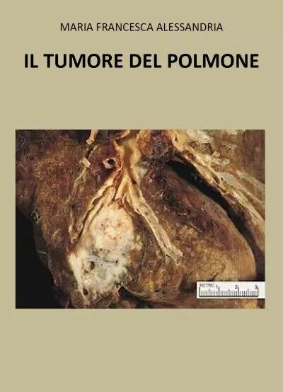 Il tumore nel polmone di Maria Francesca Alessandria, 2023, Youcanprint