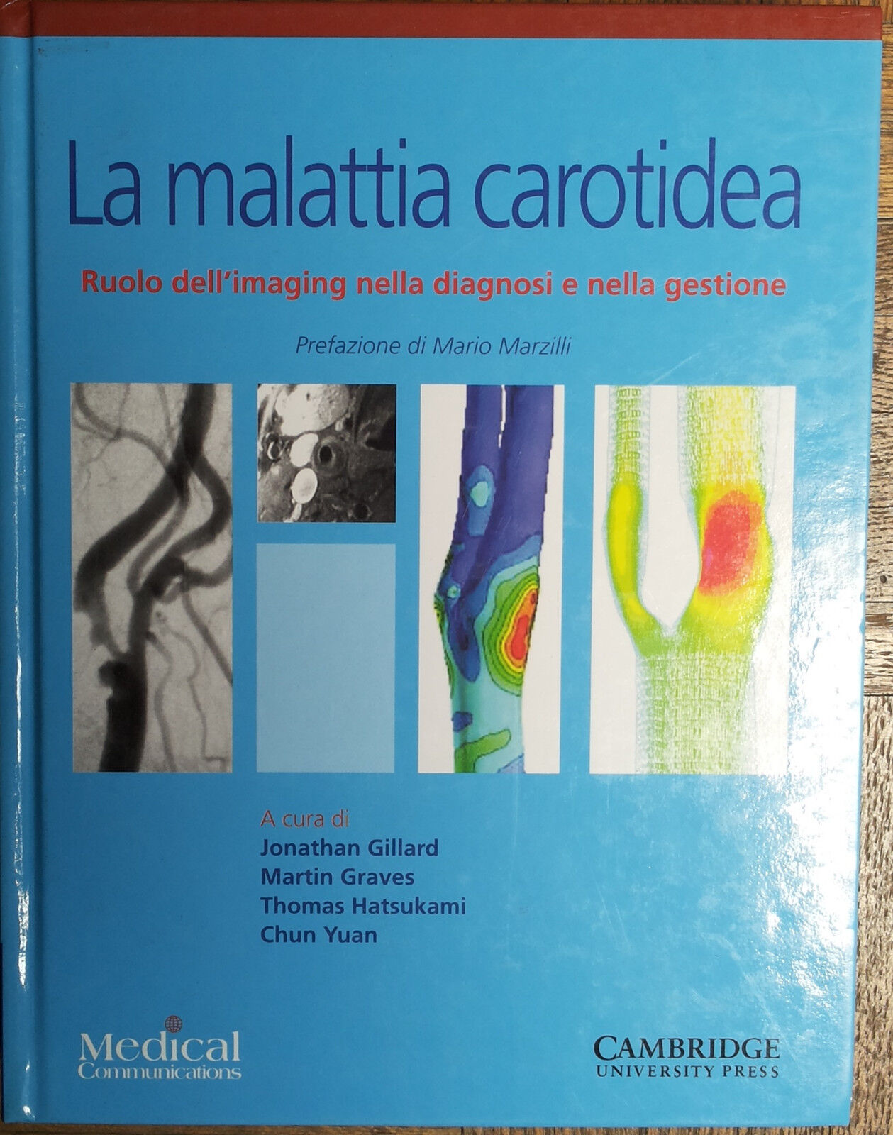 La malattia carotidea - AA.VV. - Cambridge University Press,2008 - R
