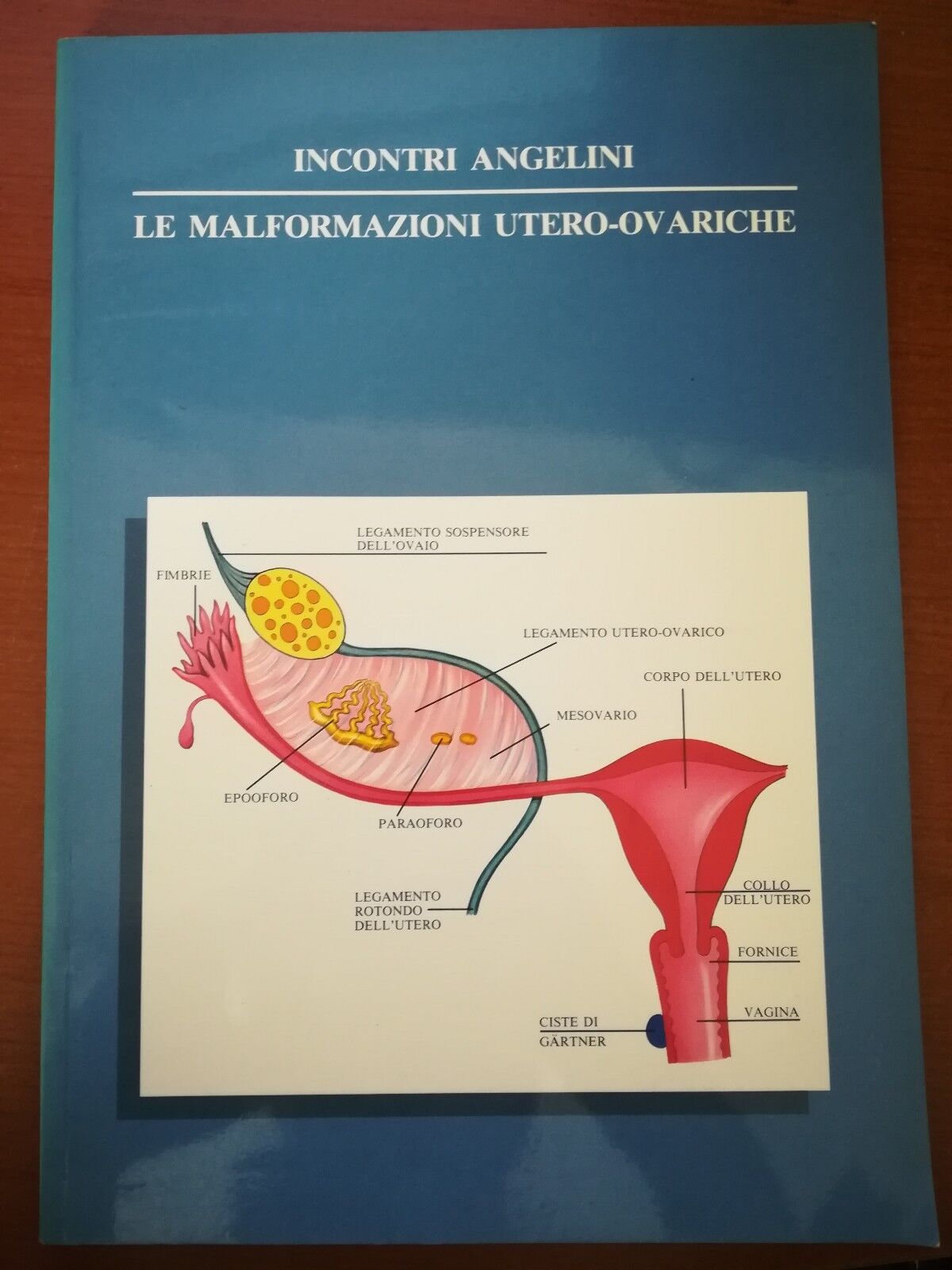 Le malformazioni utero-ovariche - AA.VV. - Incontri Angelini - 1987 - M
