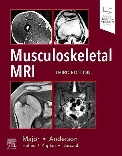 Musculoskeletal MRI - M. Anderson, N. Major - Elsevier, 2019