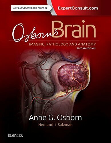 Osborn's Brain - Anne G. Osborn, Gary L. Hedlund, Karen L. Salzman - 2017