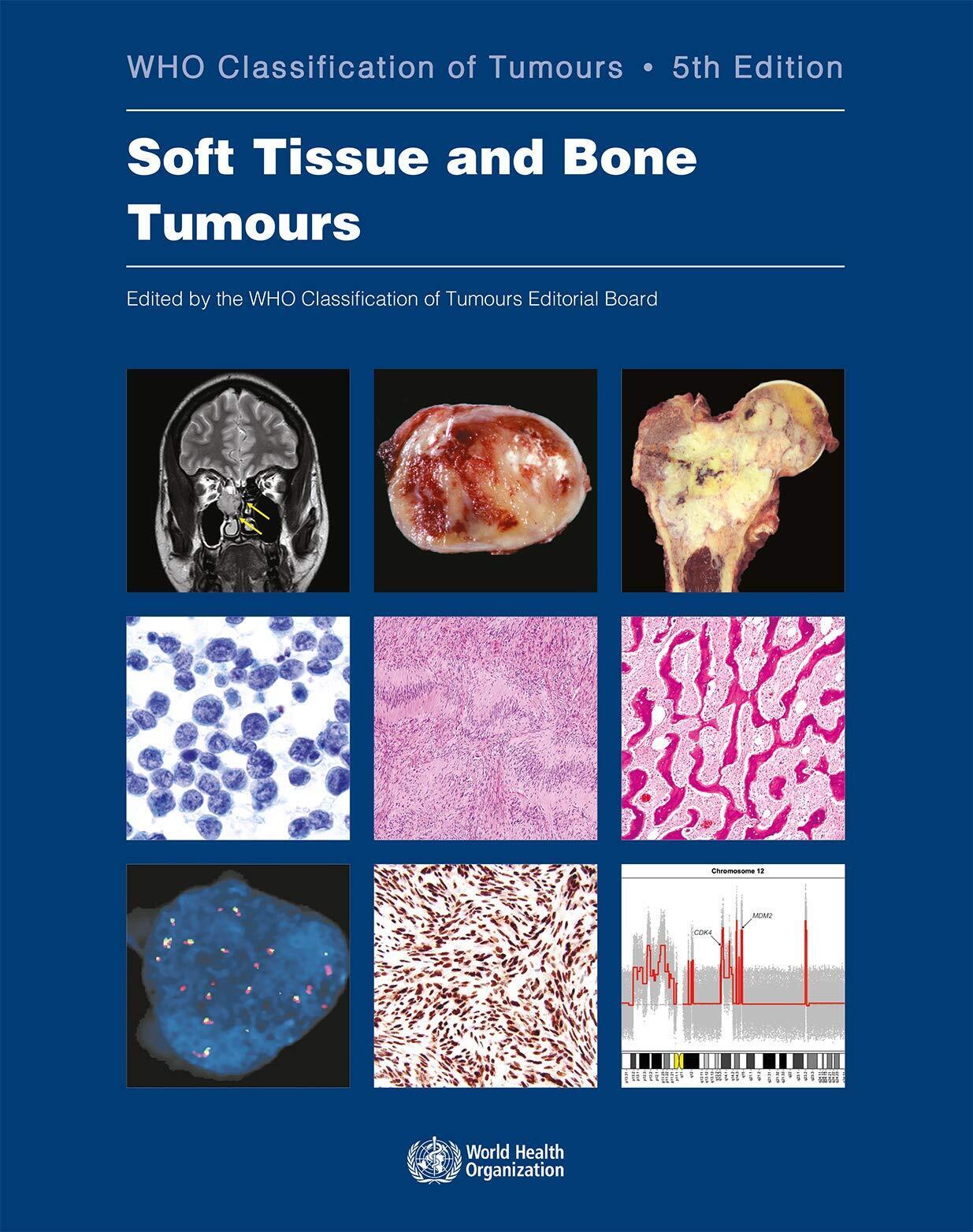 Soft Tissue and Bone Tumours - Who Classification of Tumours Editorial - 2020