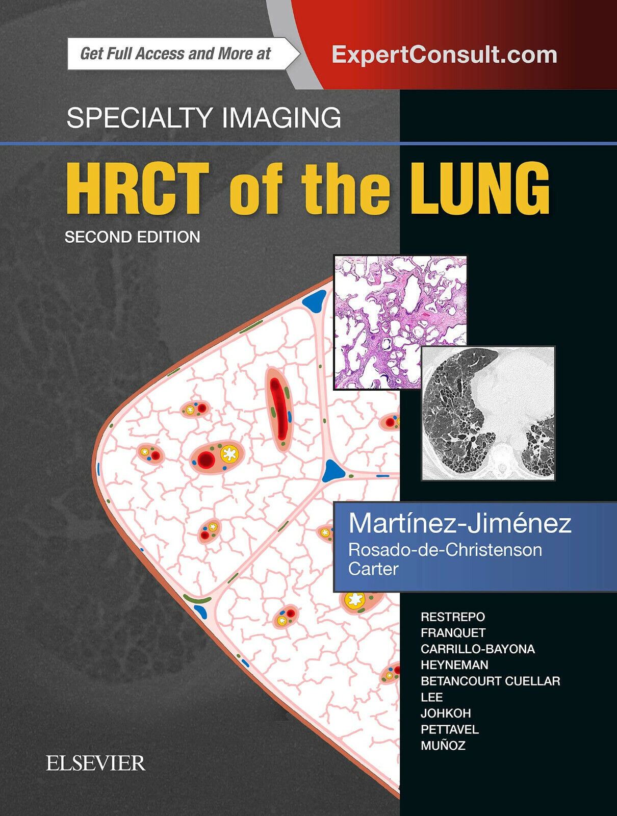 Specialty Imaging: HRCT of the Lung - Elsevier, 2017