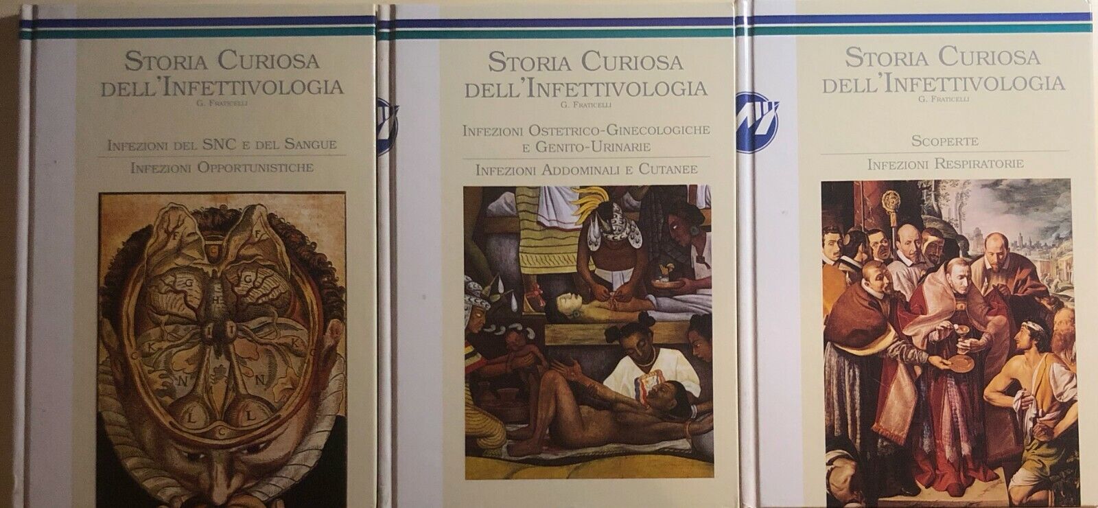 Storia curiosa delL'infettivologia 3 Volumi di G.fraticelli, Zeneca