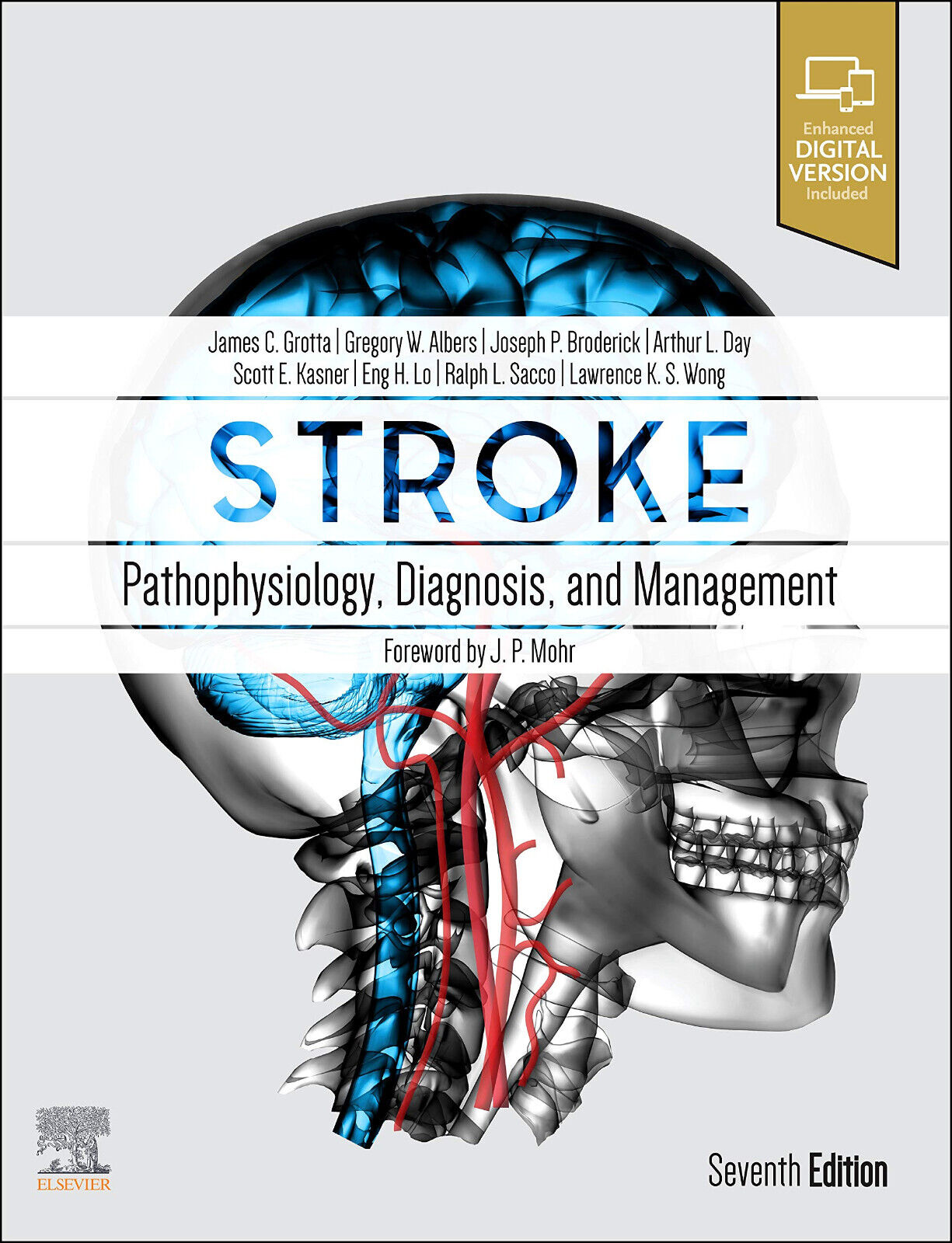 Stroke: Pathophysiology, Diagnosis, and Management - Elsevier, 2021