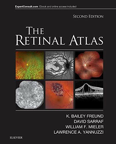 The Retinal Atlas - Elsevier  - 2016