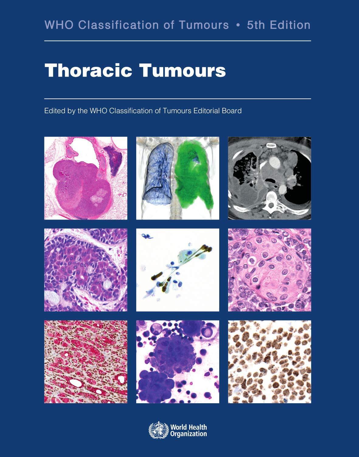 Thoracic tumours -  International Agency for Research on Cancer - 2021