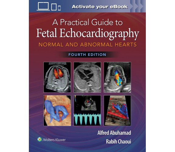 A Practical Guide to Fetal Echocardiography - Alfred Z. Abuhamad - 2022