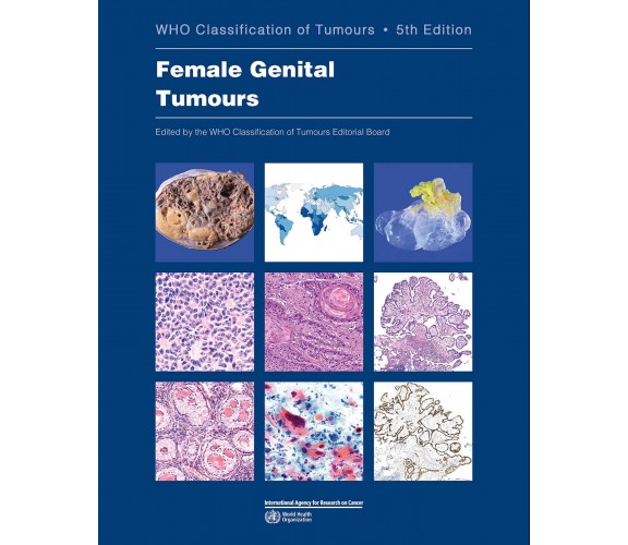 Female Genital Tumours - Who -  WORLD HEALTH ORGN, 2020