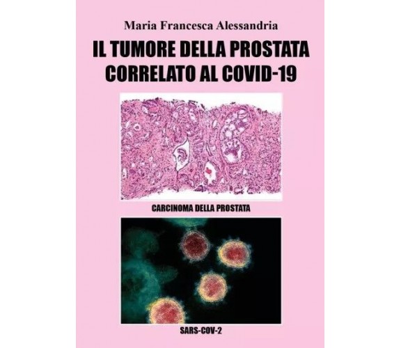 Il tumore alla prostata correlato al Covid-19 di Maria Francesca Alessandria,  