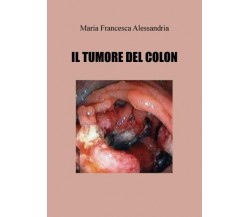 Il tumore del colon di Maria Francesca Alessandria, 2022, Youcanprint