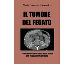 Il tumore del fegato di Maria Francesca Alessandria, 2022, Youcanprint