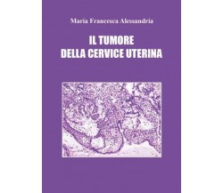 Il tumore della cervice uterina di Maria Francesca Alessandria, 2023, Youcanp