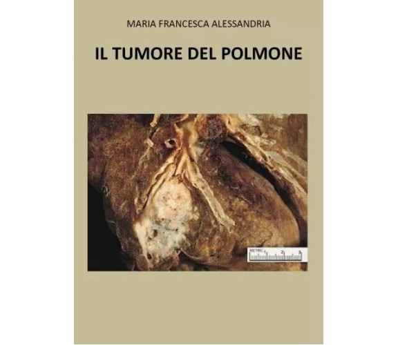 Il tumore nel polmone di Maria Francesca Alessandria, 2023, Youcanprint
