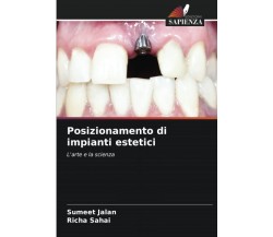 Posizionamento di impianti estetici: L'arte e la scienza - Sumeet Jalan - 2022